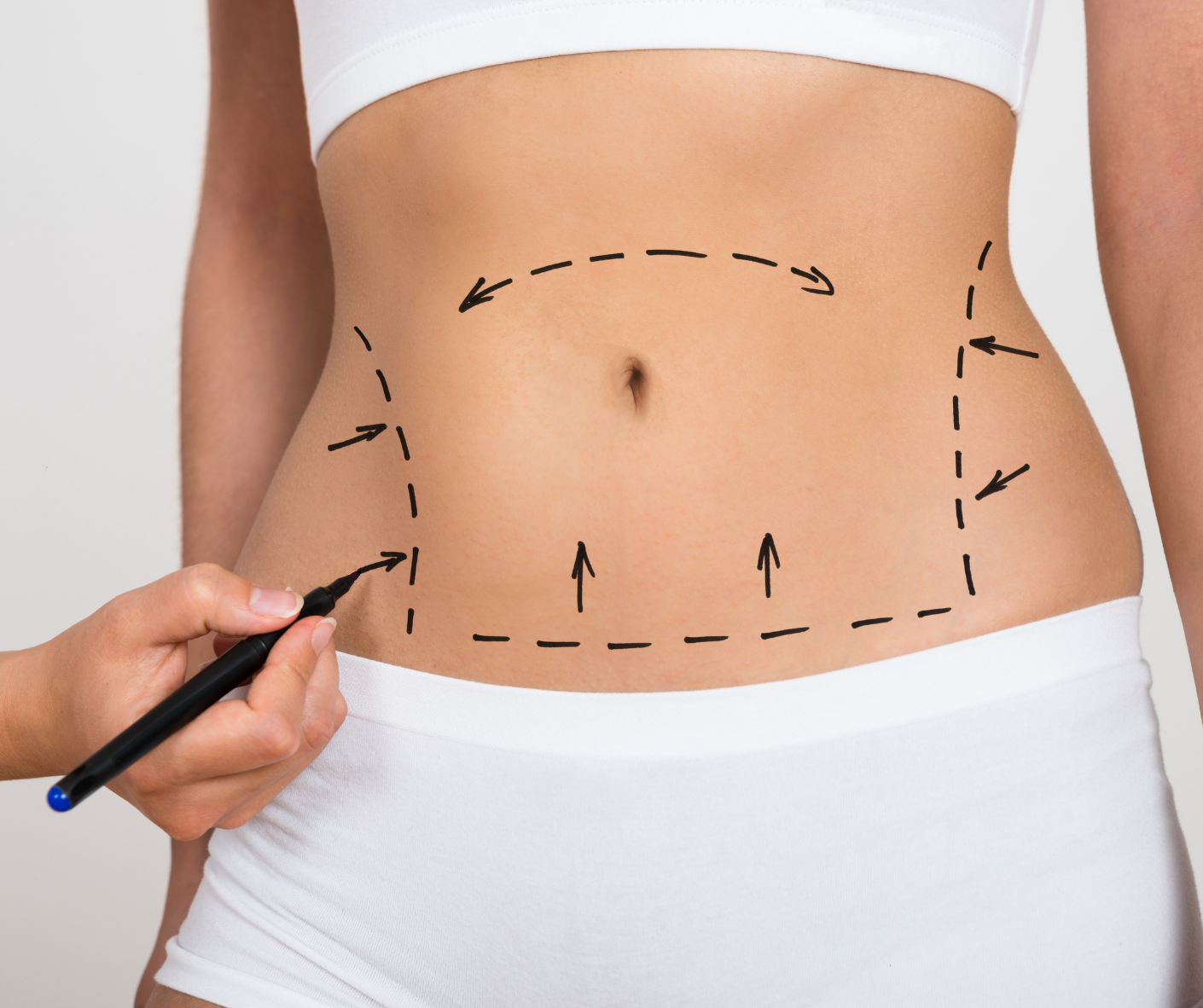 Plastická operace po redukci váhy: poslední krok k novému tělu i sebevědomí